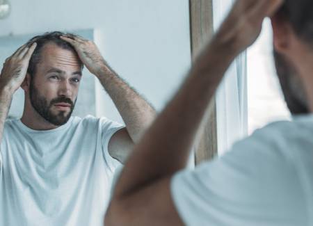 La alopecia difusa: tipos, causas y tratamiento