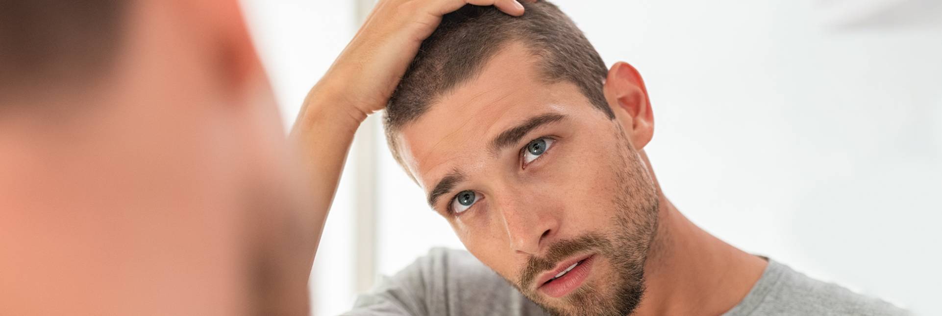 5 consejos para controlar la psoriasis en el cuero cabelludo 