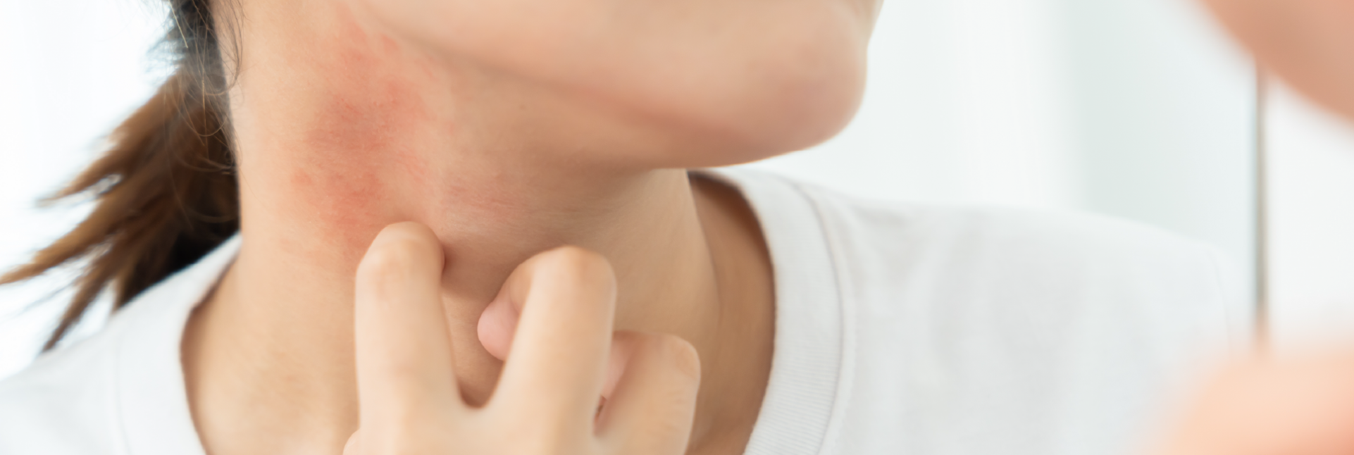 Manchas rojas en la piel: causas, tipos y tratamiento