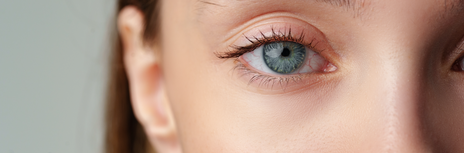 Picor de ojos: causas y tratamiento