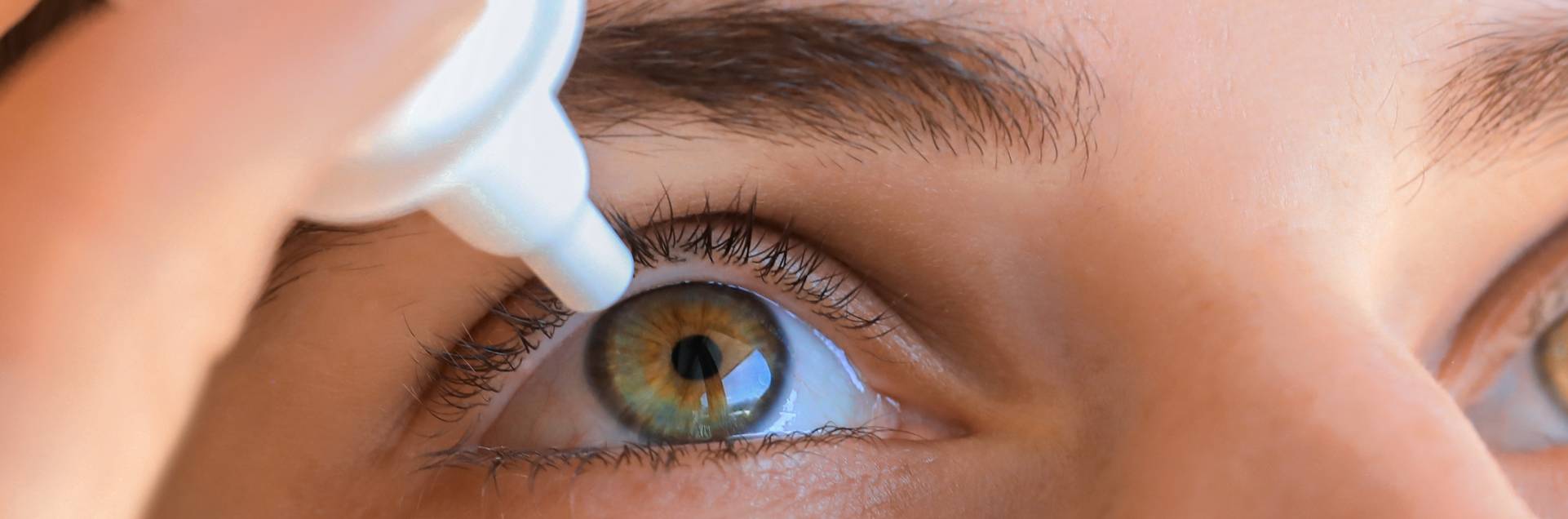 Ojo rojo: causas, síntomas y tratamientos