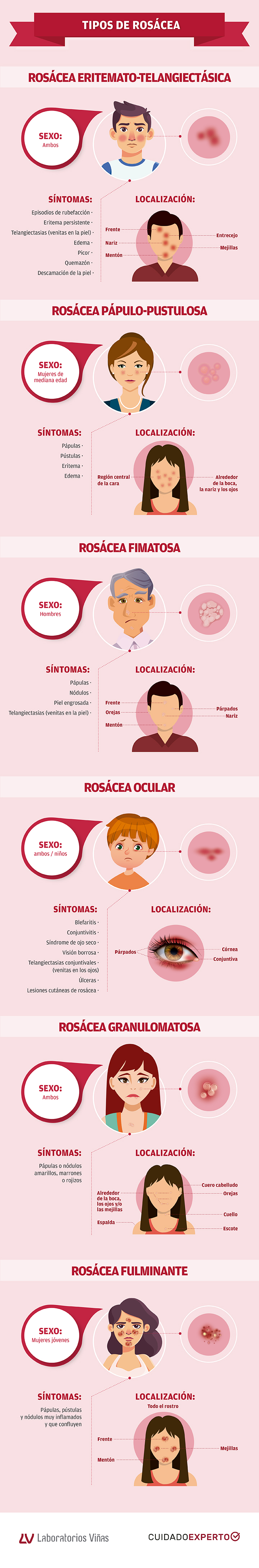 Cuellos de diferentes formas y en varios tipos de piel